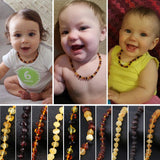 Natural Baltic Amber Teething Necklace/Bracelet - Bird and Bee Naturals